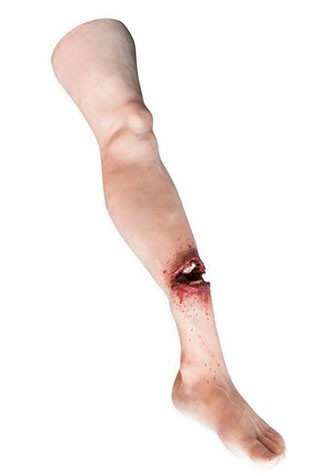 Bein mit offenem Bruch für ADAM-X Serie